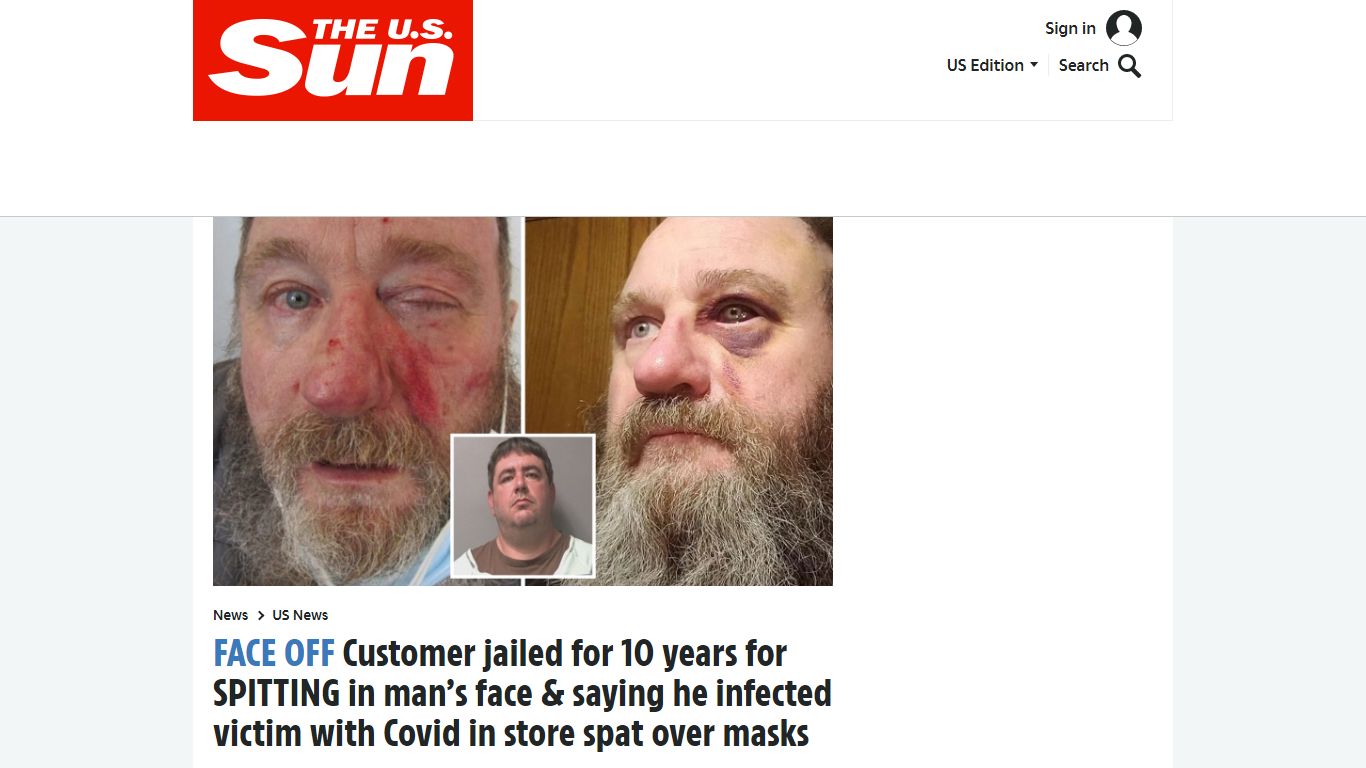 Customer jailed for 10 years for SPITTING in man's face & saying he ...